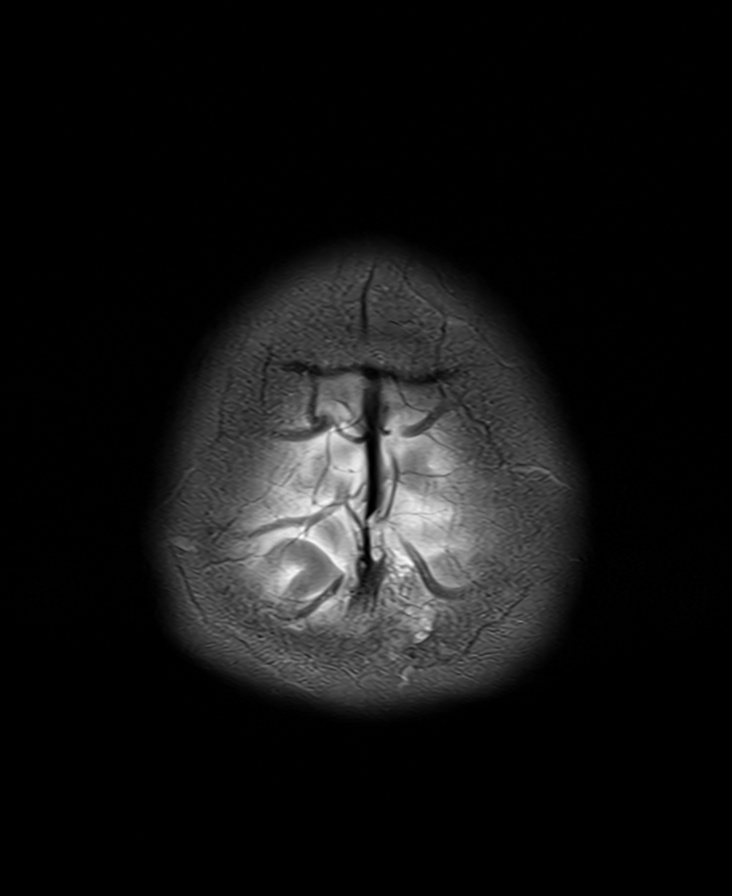 (0008, 1030) Study Description                   LO: 'Volunteer Siemens RC' 2