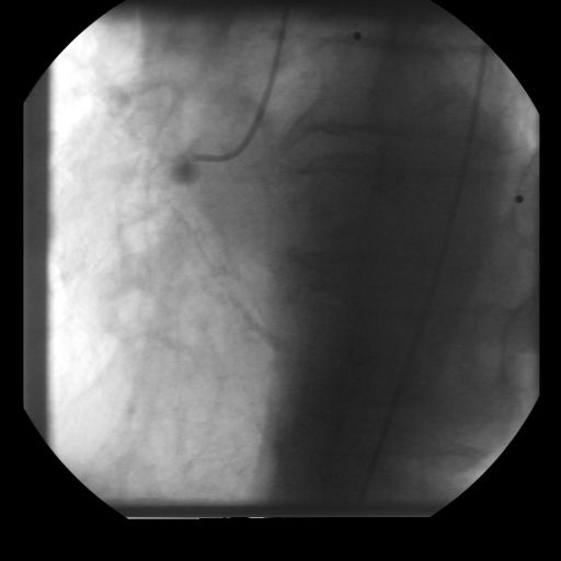 (0008, 1030) Study Description                   LO: ''